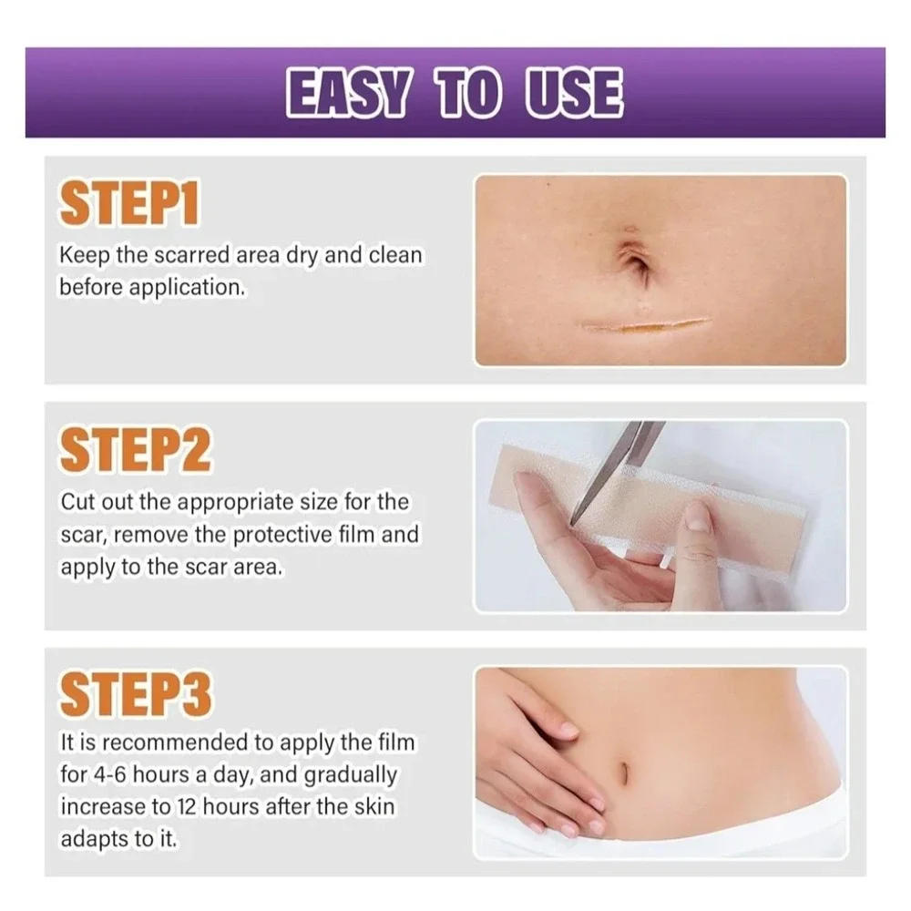 Silicone Scar Sheets,Silicone Scar Tape,Scar Tape For Surgical Scars,Silicone